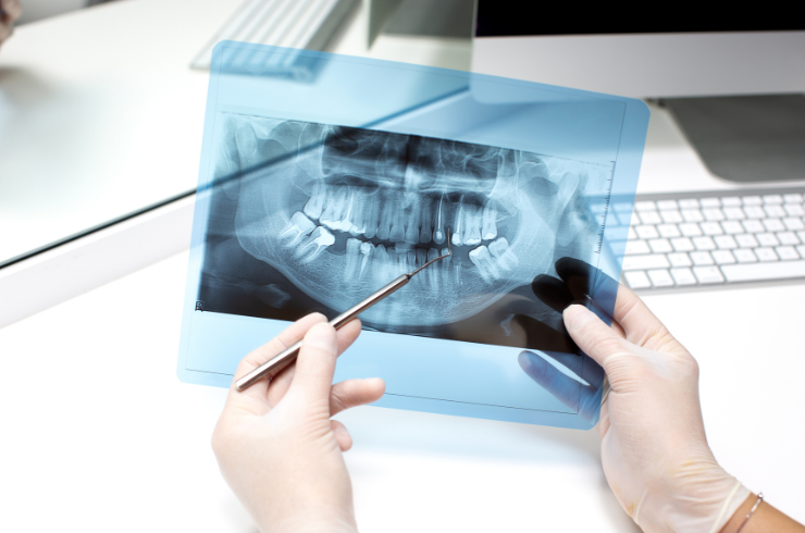 Dental xray